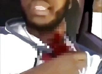 Wounded in the neck, he threatens his attacker on Instagram