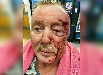 His neighbor destroys his face because his garbage smells bad