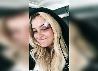 Concertgoer throws phone at Bebe Rexha: 3 stitches