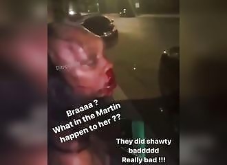 Un modèle Instragram méconnaissable après une agressions violente