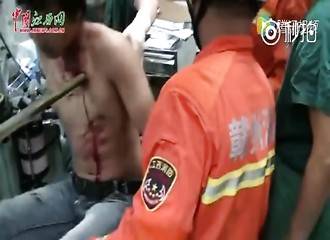 Il y a toujours des choses dingues en Chine : transporté à l’hôpital en étant transpercé par une tige de bambou