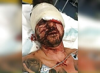 Libération d'une femme qui avait mis un coup de hache à un homme en 2017