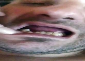 L’homme qui n’aimait pas se brosser les dents nous montre sa bouche